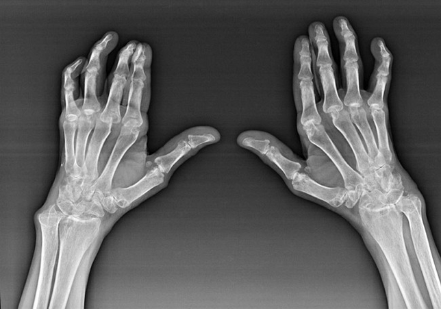 Diagnostyka stawów palców