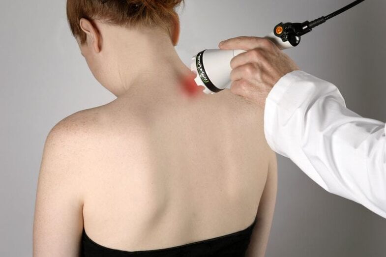 Laserowe leczenie osteochondrozy szyjnej u kobiet